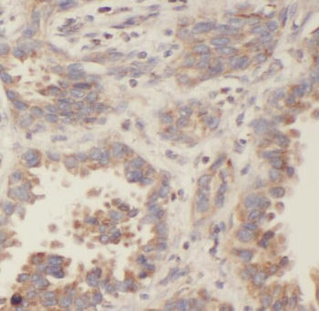 PFN2 Mouse Monoclonal Antibody