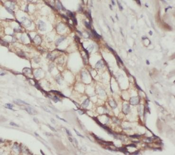 Phospho-Akt(Ser473) Antibody