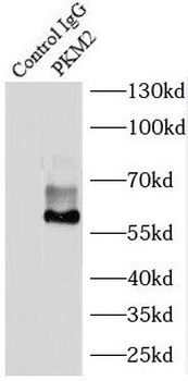 PKM2 Antibody