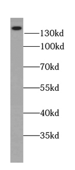 ATP2B2 Rabbit Polyclonal Antibody
