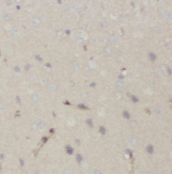 ATP2B2 Rabbit Polyclonal Antibody