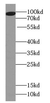 SH3RF1 Rabbit Polyclonal Antibody