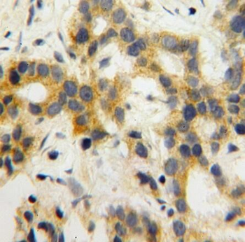 SH3RF1 Rabbit Polyclonal Antibody