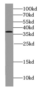 PTPA Rabbit Polyclonal Antibody