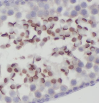PTPA Rabbit Polyclonal Antibody