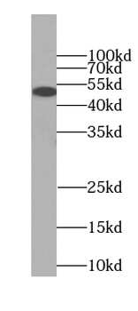 PPARD Mouse Monoclonal Antibody