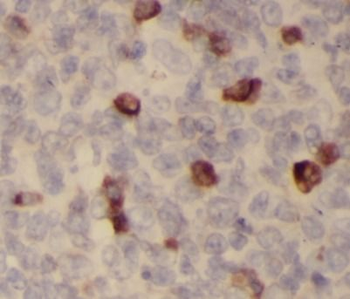 Pre-IL18 Antibody