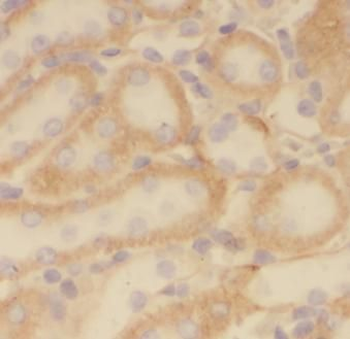 PRDX5 Antibody