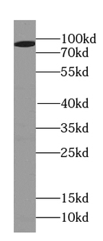 PSD2 Antibody
