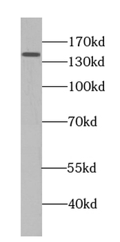 PSME4 Rabbit Polyclonal Antibody