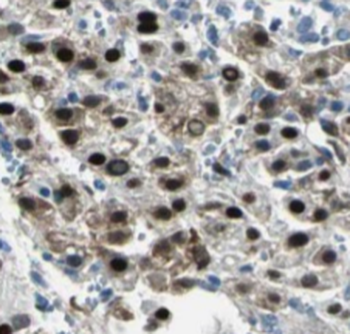 PSME4 Rabbit Polyclonal Antibody