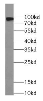 PYGM Specific Rabbit Polyclonal Antibody