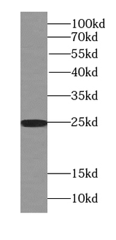 RAB3A specific Rabbit Polyclonal Antibody
