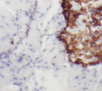 RAB3A specific Rabbit Polyclonal Antibody