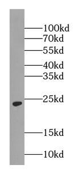 RAB5A Specific Rabbit Polyclonal Antibody