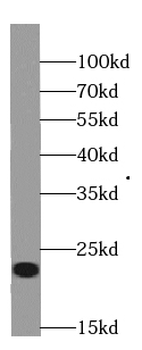 RBBP9 Mouse Monoclonal Antibody
