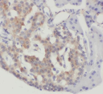 RBBP9 Mouse Monoclonal Antibody