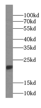 RBBP9 Mouse Monoclonal Antibody