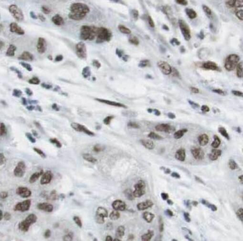 RBBP9 Mouse Monoclonal Antibody