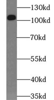 RBM15 Mouse Monoclonal Antibody