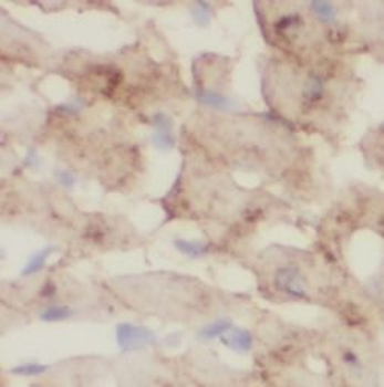 ATP6AP2 Rabbit Polyclonal Antibody