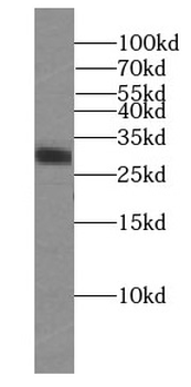 RIMS4 Specific Rabbit Polyclonal Antibody