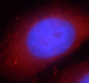 RIPK1 Specific Rabbit Polyclonal Antibody