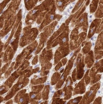 RIPK1 Specific Rabbit Polyclonal Antibody