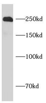 ROBO1 Specific Rabbit Polyclonal Antibody
