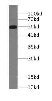 ROBO3 Specific Rabbit Polyclonal Antibody