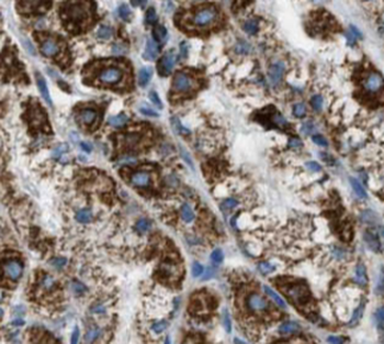 ROBO3 Specific Rabbit Polyclonal Antibody