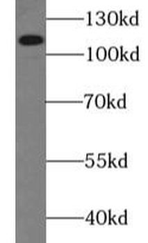ROBO4 Specific Rabbit Polyclonal Antibody