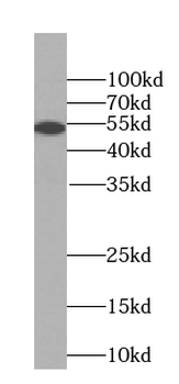 RTCB Specific Rabbit Polyclonal Antibody