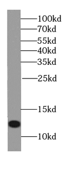 S100A11 Mouse Monoclonal Antibody