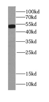 RPS6KB2 Rabbit Polyclonal Antibody
