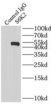 RPS6KB2 Rabbit Polyclonal Antibody
