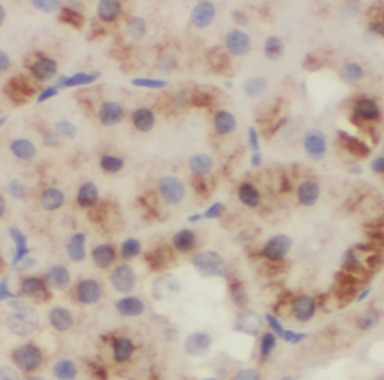 RPS6KB2 Rabbit Polyclonal Antibody