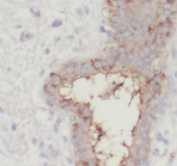 EXOC2 Rabbit Polyclonal Antibody