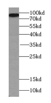 EXOC3 Rabbit Polyclonal Antibody