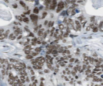 EXOC3 Rabbit Polyclonal Antibody