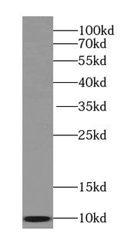 SEC61B Specific Rabbit Polyclonal Antibody