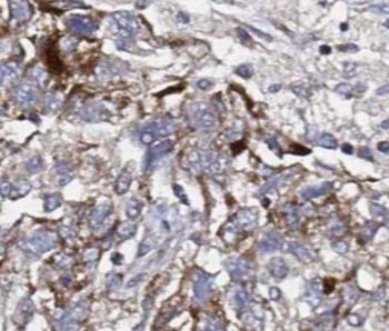 SEC61B Specific Rabbit Polyclonal Antibody