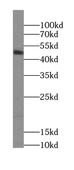 SEPTIN10 Rabbit Polyclonal Antibody