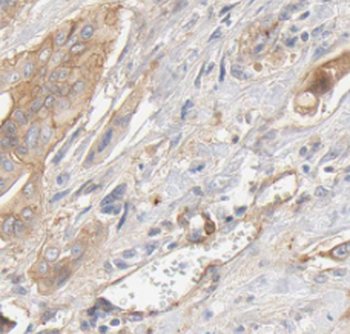 SEPTIN10 Rabbit Polyclonal Antibody