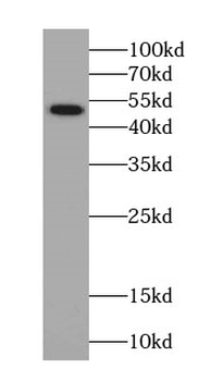 SEPTIN14 Rabbit Polyclonal Antibody