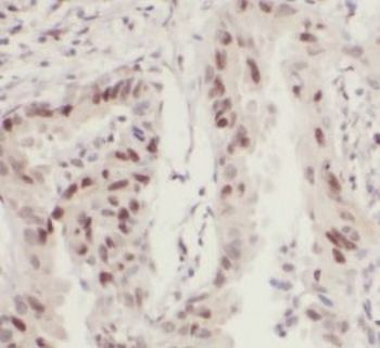 SEPTIN7 Antibody