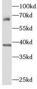 SEPTIN9 Rabbit Polyclonal Antibody