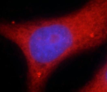 SEPTIN9 Rabbit Polyclonal Antibody