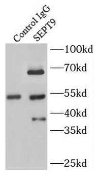 SEPTIN9 Rabbit Polyclonal Antibody