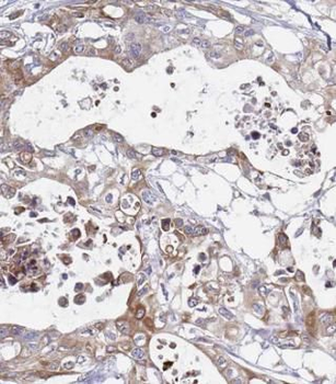 SEPTIN9 Rabbit Polyclonal Antibody